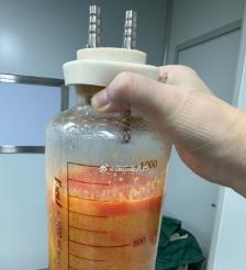 萍乡水动力吸脂手术要做多久？